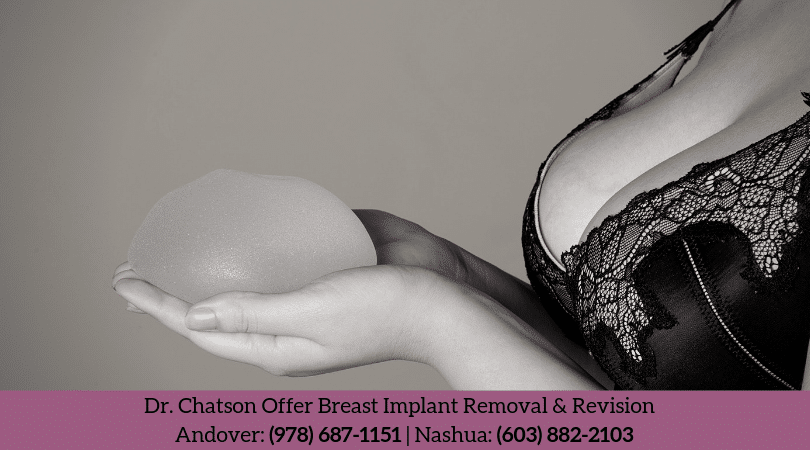 Will I Need a Breast Lift After Breast Implant Removal? - George P.  Chatson, M.D.