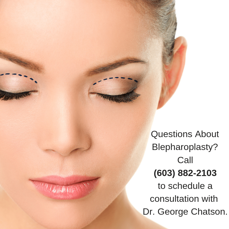 Nashua Eyelid Lift | Blepharoplasty New Hampshire