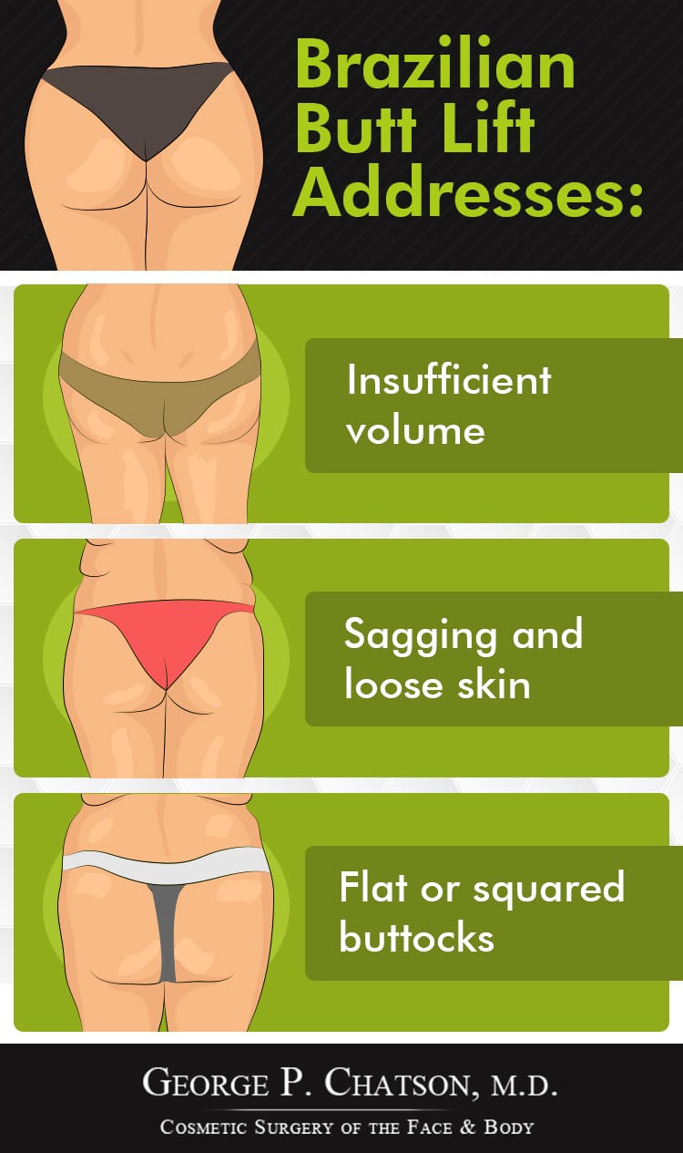 Infographic: What can a Brazilian Butt Lift Fix?