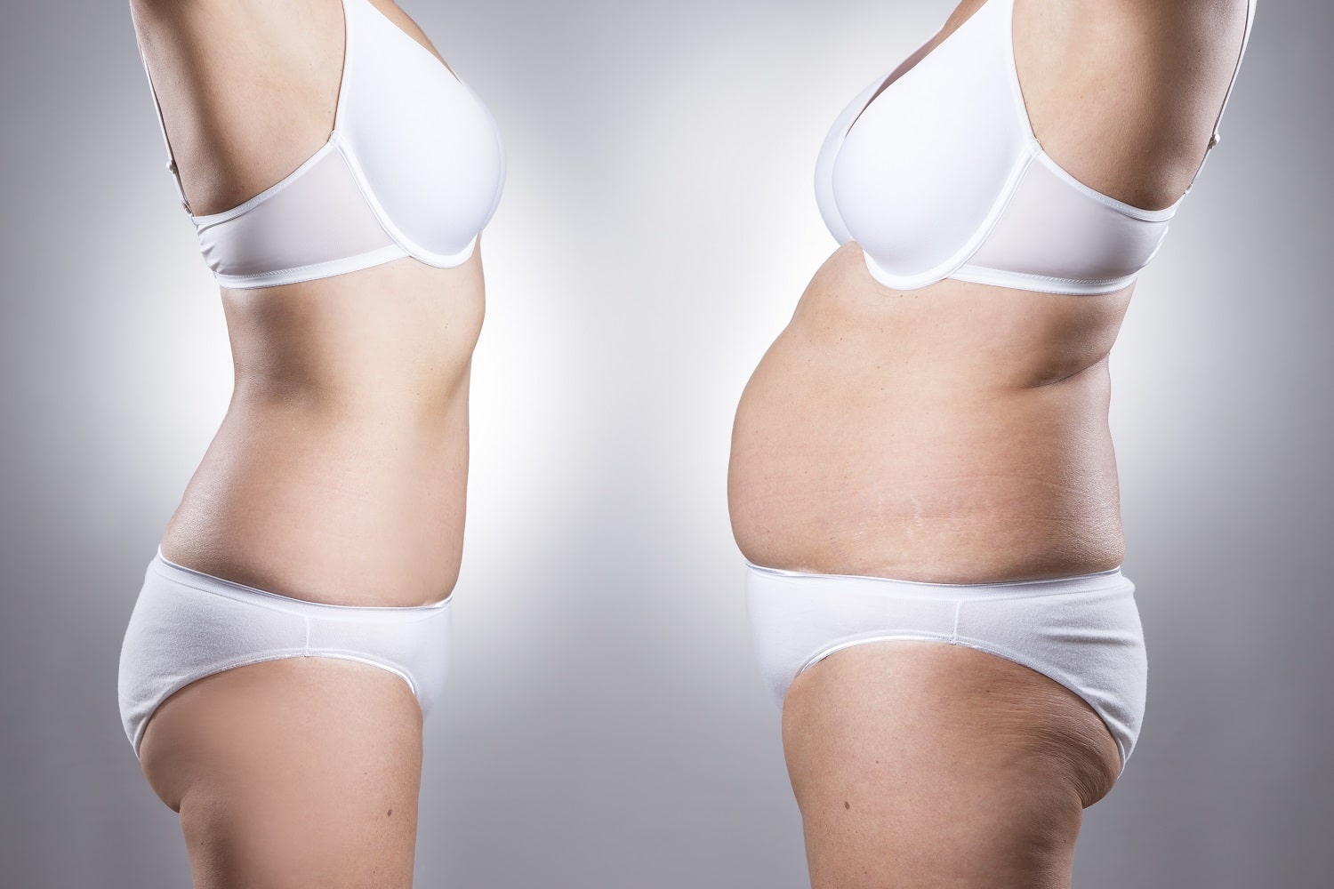 Can Tummy Tuck Surgery be Covered by Insurance? - George P. Chatson, M.D.