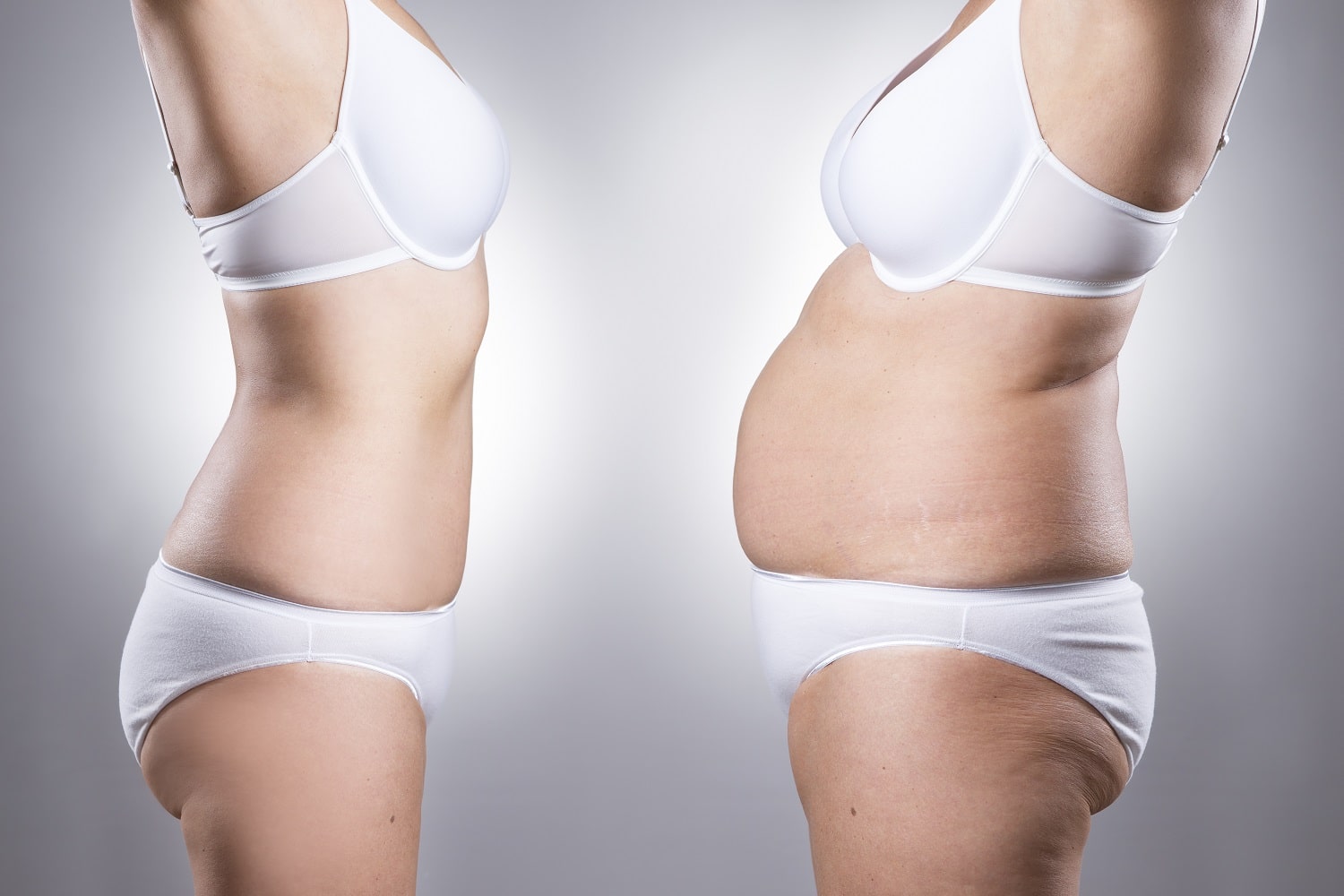 Financing Abdominoplasty | Nashua, NH | Andover, MA