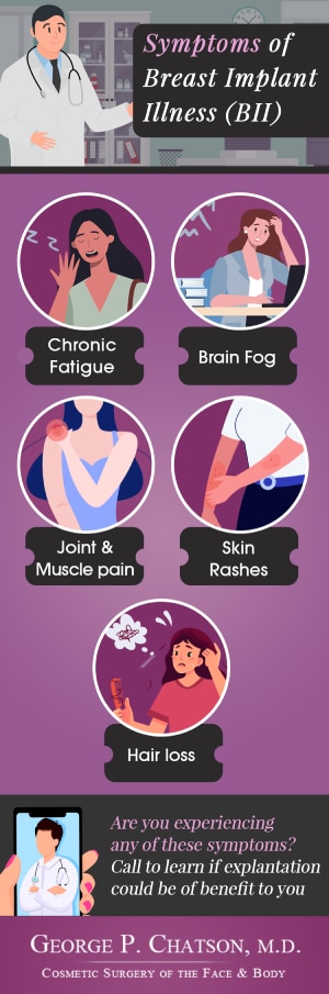 Infographic: What are the Symptoms of Breast Implant Illness?