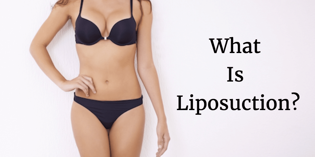 What Is Liposuction