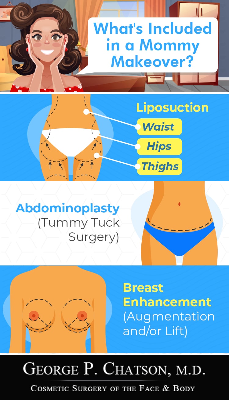 What's Included in a Mommy Makeover Infographic | Breast Surgery | Liposuction | Tummy Tuck