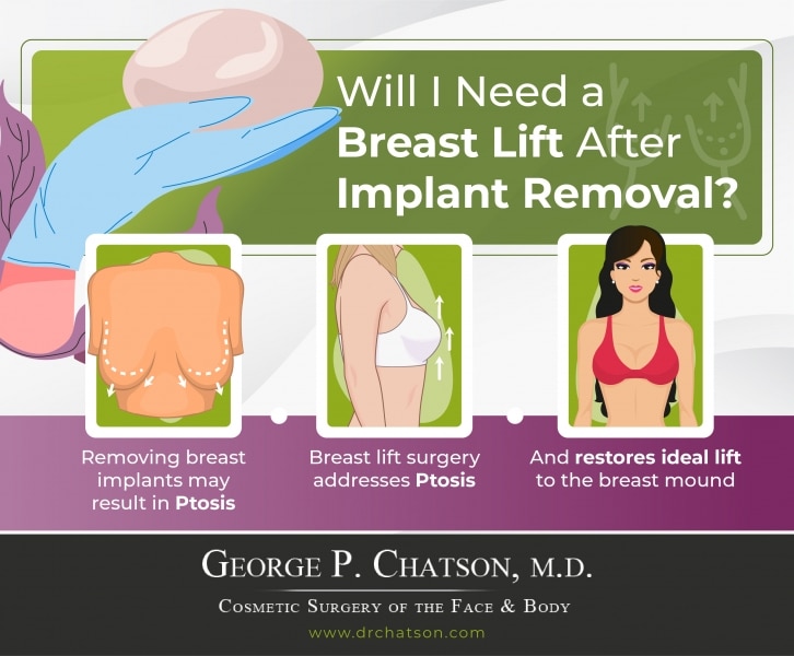 Will I Need a Breast Lift After Breast Implant Removal? - George P.  Chatson, M.D.