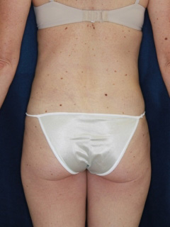 After Image